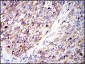 G6PD Antibody