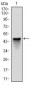 NQO1 Antibody