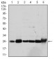 GSTM1 Antibody