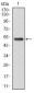 GSTM1 Antibody