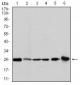 GSTM1 Antibody