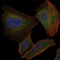 TNNI2 Antibody