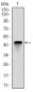 TNNI2 Antibody