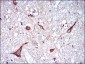 NEFL Antibody