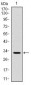 CD30 Antibody