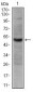 CD30 Antibody