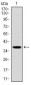 FOXO1 Antibody