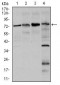 FOXO1 Antibody