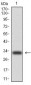 CK5 Antibody