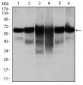 CK5 Antibody