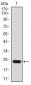 troponin T2 Antibody