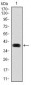 MAP1LC3B Antibody