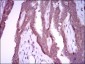 NOS2 Antibody