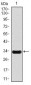 NOS2 Antibody