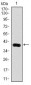 KLK3 Antibody