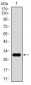 GPC3 Antibody