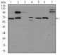 GPC3 Antibody