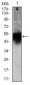 DCX Antibody