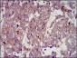 IGF2 Antibody