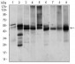 ILK Antibody