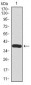 SST Antibody