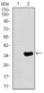 NEFH Antibody