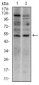 T Antibody