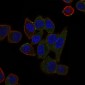 ABCB5 Antibody