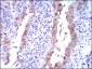 CDKN2A Antibody