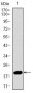 CDKN2A Antibody