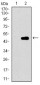 CDKN2A Antibody