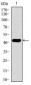 TUBB2A Antibody