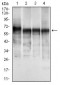 CK5 Antibody