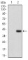 CD7 Antibody