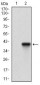 ACP5 Antibody