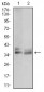 ACP5 Antibody