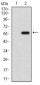 GPNMB Antibody