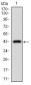 ABCC4 Antibody