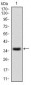 IL2RA Antibody