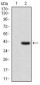 IL2RA Antibody