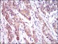 ABCC4 Antibody