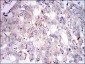 PLIN2 Antibody