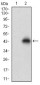 NPC1 Antibody