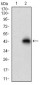 ACP5 Antibody