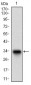 DCN Antibody