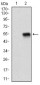 ZEB1 Antibody