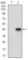 CD22 Antibody