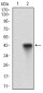 CD22 Antibody