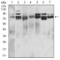 CD22 Antibody