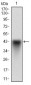 SYCP3 Antibody